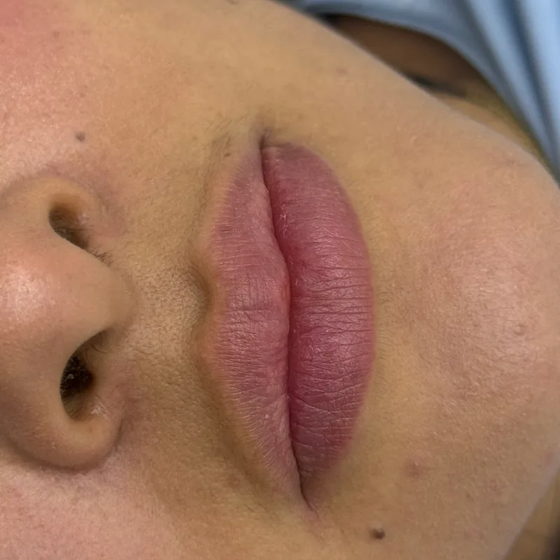 Before: lips without definition