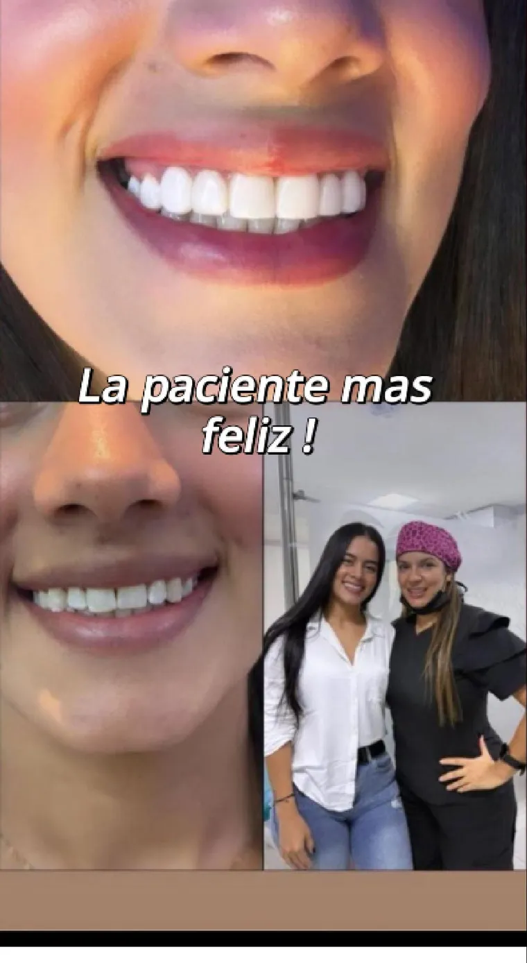 Smile design: the patient before and after